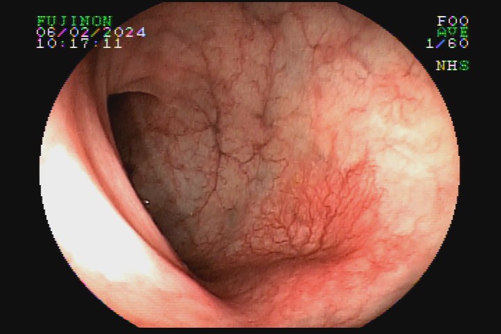 ARTUR ANTONIO NOBRE (9429) #2007637796.jpg