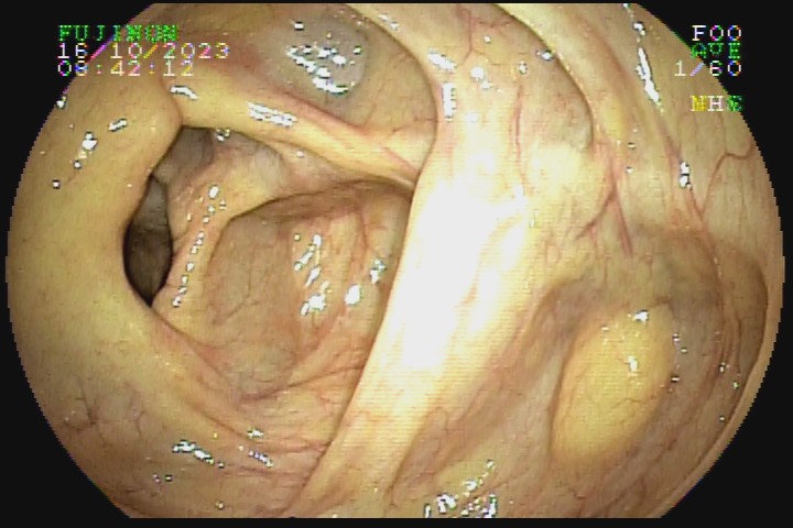 TEREZINHA TEIXEIRA CUSTODIO (8684) #2007604840.jpg